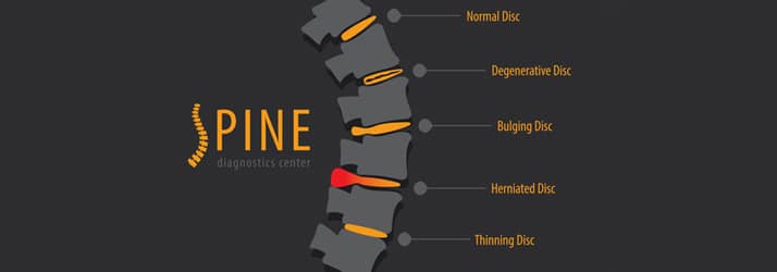 Spinal-Wellness-Tips Spinal Wellness Tips