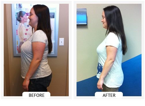 Chiropractic Wilmington DE Before and After Results ang Chiropractic Wilmington DE Before and After Results ang