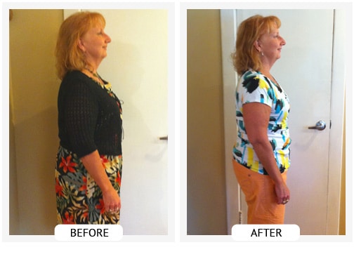 Chiropractic Wilmington DE Before and After Results barb Chiropractic Wilmington DE Before and After Results barb
