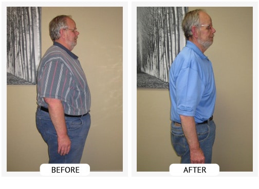Chiropractic Wilmington DE Before and After Results Chiropractic Wilmington DE Before and After Results