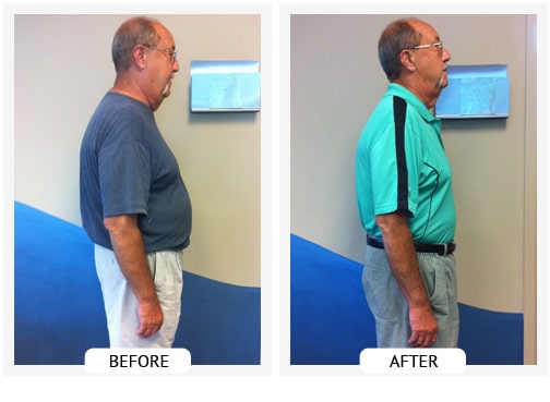 Chiropractic Wilmington DE Before and After Results dan_sm Chiropractic Wilmington DE Before and After Results dan_sm
