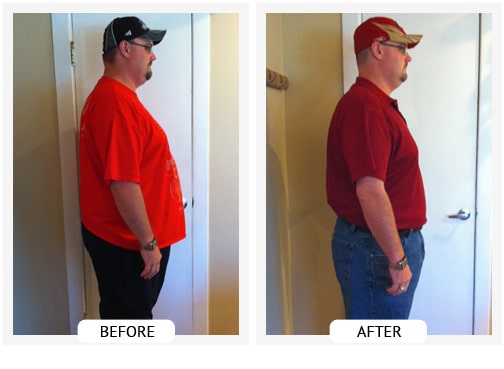 Chiropractic Wilmington DE Before and After Results don Chiropractic Wilmington DE Before and After Results don