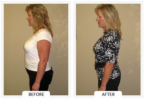 Chiropractic Wilmington DE Before and After Results lana Chiropractic Wilmington DE Before and After Results lana