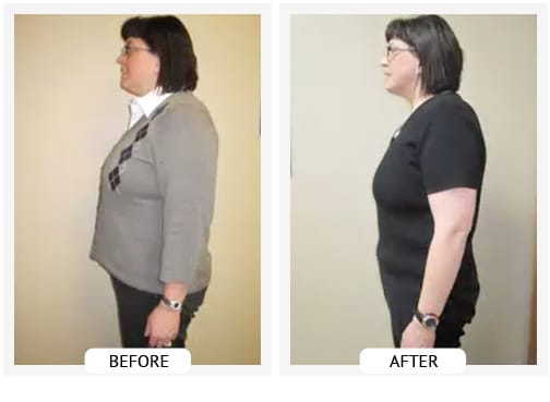 Chiropractic Wilmington DE Before and After Results lisa Chiropractic Wilmington DE Before and After Results lisa