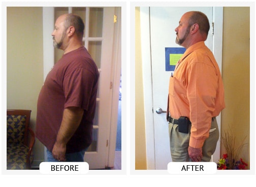 Chiropractic Wilmington DE Before and After Results roland Chiropractic Wilmington DE Before and After Results roland