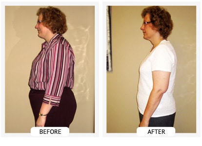 Chiropractic Wilmington DE Before and After Results Sherry Chiropractic Wilmington DE Before and After Results Sherry